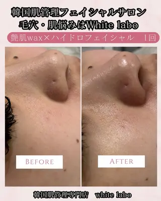 韓国肌管理専門店　White labo 梅田店所属・ホワイトラボ梅田 ｜毛穴・韓国肌管理のエステ・リラクイメージ
