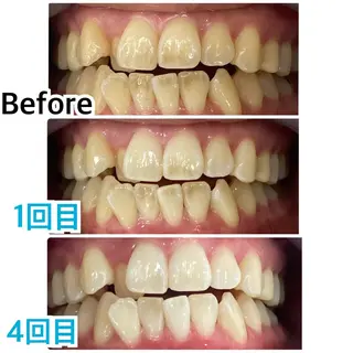 プラチナムビューティー柏所属・【歯科提携】柏ホワイ トニングスタイルのその他イメージ