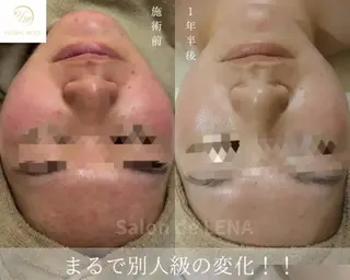 Grandir所属・ハーブピーリング専門 グランディール　武内のエステ・リラクイメージ