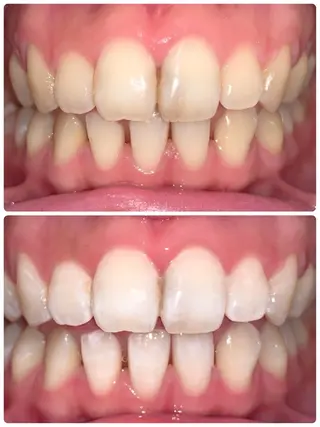 LOVE ホワイトニング渋谷のその他イメージ