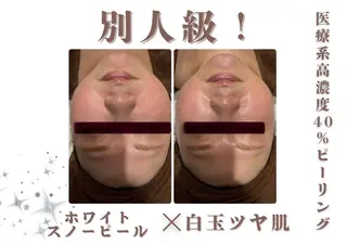 🎀美肌ケアサロン 🎀レイビス銀座店のエステ・リラクイメージ