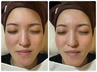 cicer よもぎ蒸し・ハーブピーリング所属・cicer🌿 Naomi☺︎☺︎のエステ・リラクイメージ