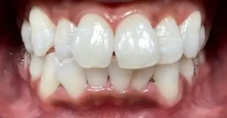 セルフホワイトニングサロン　ラヴィアン所属・ホワイトニングサロン La vie enのその他イメージ