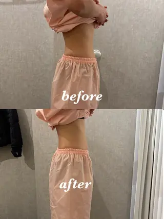 メンズ 腸活サポート みなみののエステ・リラクイメージ