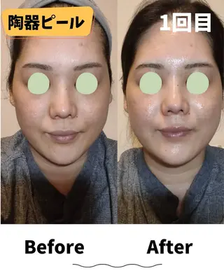 コンセプトサロン〜友〜所属・コンセプトサロン友 木下のエステ・リラクイメージ