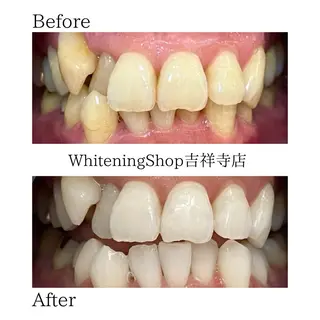 ホワイトニング ショップ吉祥寺店のエステ・リラクイメージ