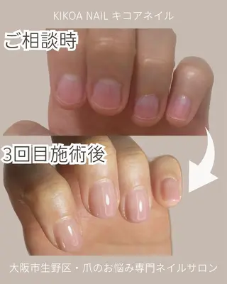 ネイル KIKOA NAIL キコアネイルのネイルデザイン