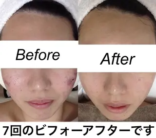 都度払い肌質改善 &脱毛Blancheのエステ・リラクイメージ