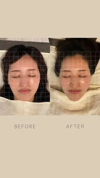 美容鍼サロン ハピネス所属・土手 真矢のその他イメージ