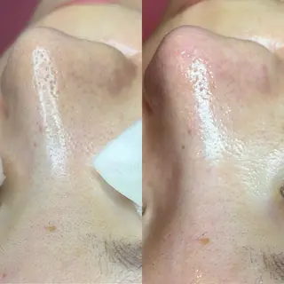 Salon de A所属・【美肌専門店】 Salon de Aのエステ・リラクイメージ