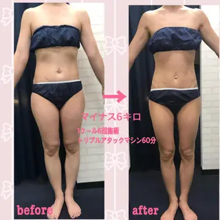 アイトータル ビューティーのエステ・リラクイメージ