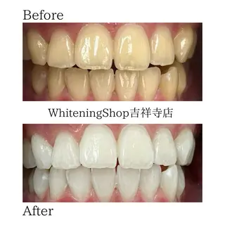 ホワイトニングショッ 吉祥寺2号店のその他イメージ