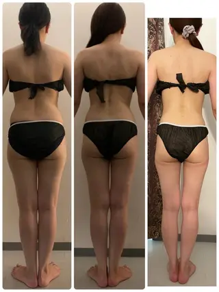 高速脱毛エステ リアンのエステ・リラクイメージ