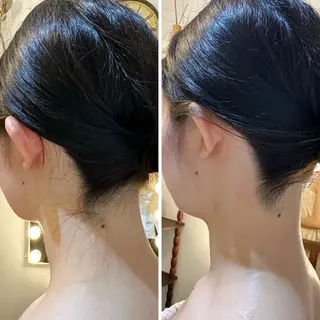 うなじ脱毛/美肌脱毛 LABELのエステ・リラクイメージ