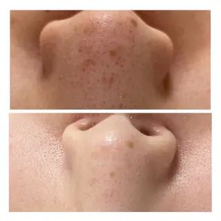 美肌脱毛サロンGrande所属・別府脱毛サロン Grandeのエステ・リラクイメージ