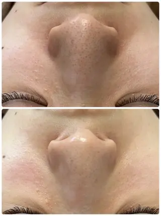 メンズ 美Face所属・美 Faceのエステ・リラクイメージ