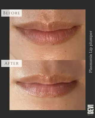 Bevi salonのその他イメージ