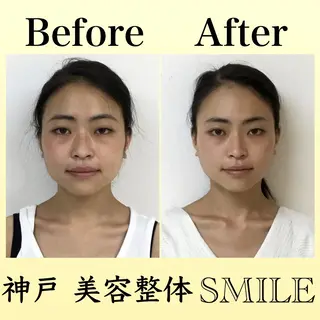 【小顔・姿勢矯正】 美容整体 SMILEのエステ・リラクイメージ