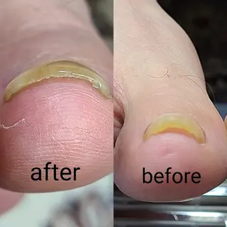 ネイル Nail  Ai    のネイルデザイン