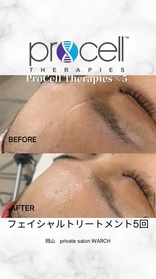 WARCH Marieのその他イメージ