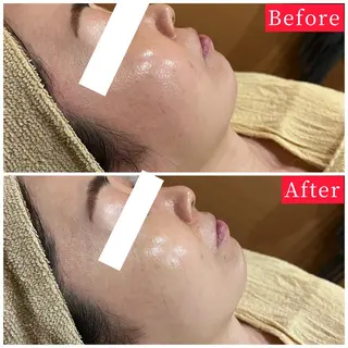 ハーブピーリング専門 muro.のエステ・リラクイメージ