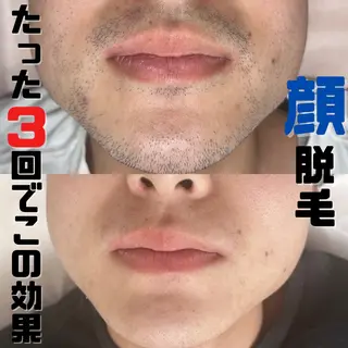 メンズ Diailes💎 さいかのエステ・リラクイメージ