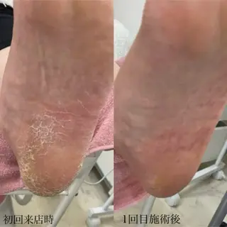 Beauty Lounge relle(リル)所属・relle 🥀✨ Kuronoのネイルデザイン