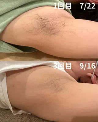 oui-oui　ウィウィ所属・oui-oui 磐田脱毛のエステ・リラクイメージ