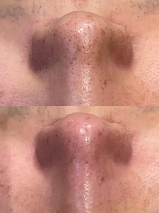 sii センター北 AIのエステ・リラクイメージ