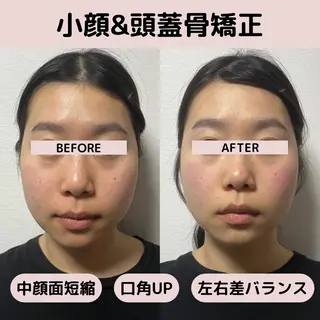 小顔矯正/骨格矯正 AKANEのエステ・リラクイメージ