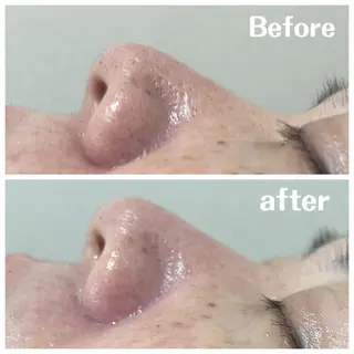 肌質改善サロン facialmoonのエステ・リラクイメージ