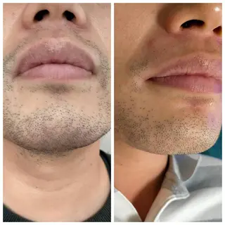 muscle＆esthe jonny's beauty所属・jonny's beautyのエステ・リラクイメージ