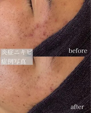 écla【中崎町】 yukikoのエステ・リラクイメージ