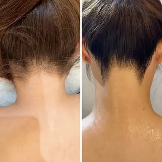 うなじ脱毛/美肌脱毛 LABELのエステ・リラクイメージ