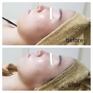 eminy所属・Yuuki 陶肌トリートメントのエステ・リラクイメージ