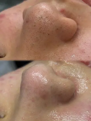 小顔矯正&リンパ専門店EMIER(エミエル)所属・福井二の宮EMIER /ゆきのエステ・リラクイメージ