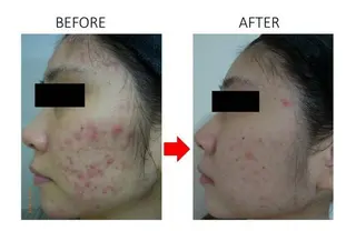 肌質改善専門サロン ／FSS渋谷店　松本のエステ・リラクイメージ