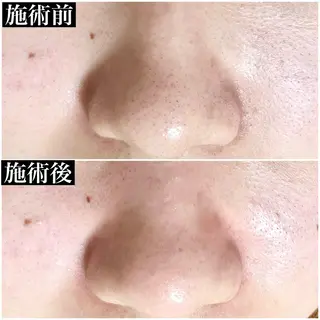 U eyes ちかのマツエク・マツパデザイン