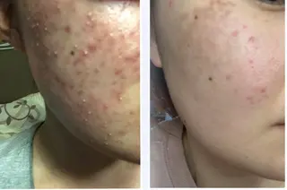 メナードフェイシャルサロン小山東城南所属・村田 結加のエステ・リラクイメージ