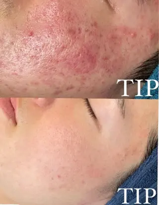 Ellebeauty relaxationのエステ・リラクイメージ