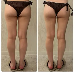 痩身/デトックス しほのエステ・リラクイメージ