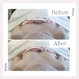 【バスト専門店 】 Kiana のエステ・リラクイメージ