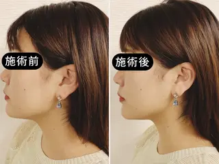 渋谷 小顔美容鍼 専門サロン YZのエステ・リラクイメージ