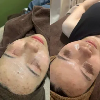 LUMIERE福岡春吉店所属・LUMIERE 福岡のエステ・リラクイメージ