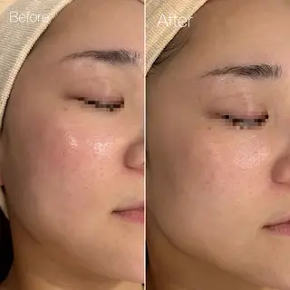 〈etre〉トータルビューティーサロン所属・etre - 韓国肌管理 -のエステ・リラクイメージ