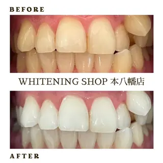 メンズ ホワイトニング ショップ本八幡店のエステ・リラクイメージ