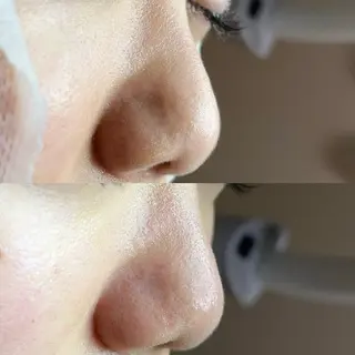 毛穴ケア・ヘッドスパサロンSHINY(シャイニー)所属・毛穴ケア・ヘッドスパ サロンSHINYのエステ・リラクイメージ