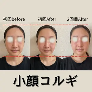 小顔コルギ&肌質改善 の専門店LIBREのエステ・リラクイメージ