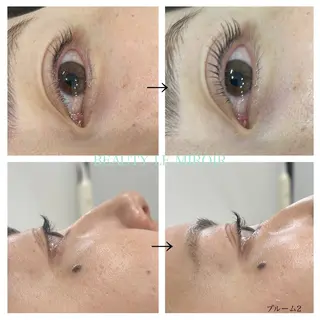 マツエク・マツパ ビューティー ミロワールのエステ・リラクイメージ