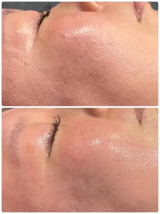 salon de ete合志市のエステ・リラクイメージ